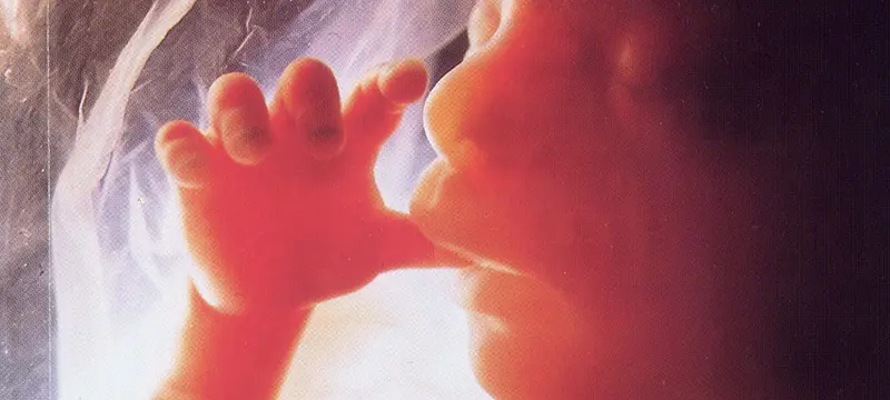 Newborn infant